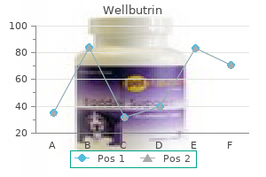300 mg wellbutrin amex