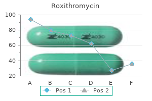 150 mg roxithromycin