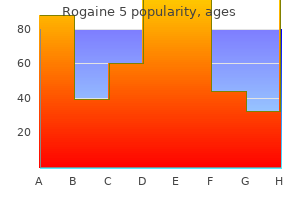 purchase rogaine 5 us